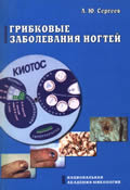 Грибковые заболевания ногтей